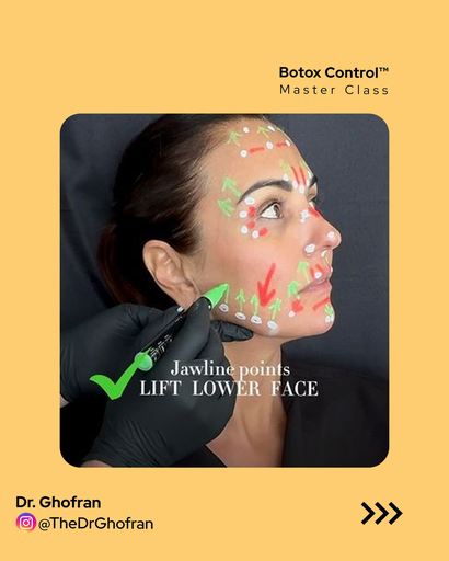 Botox Control™  Master Class